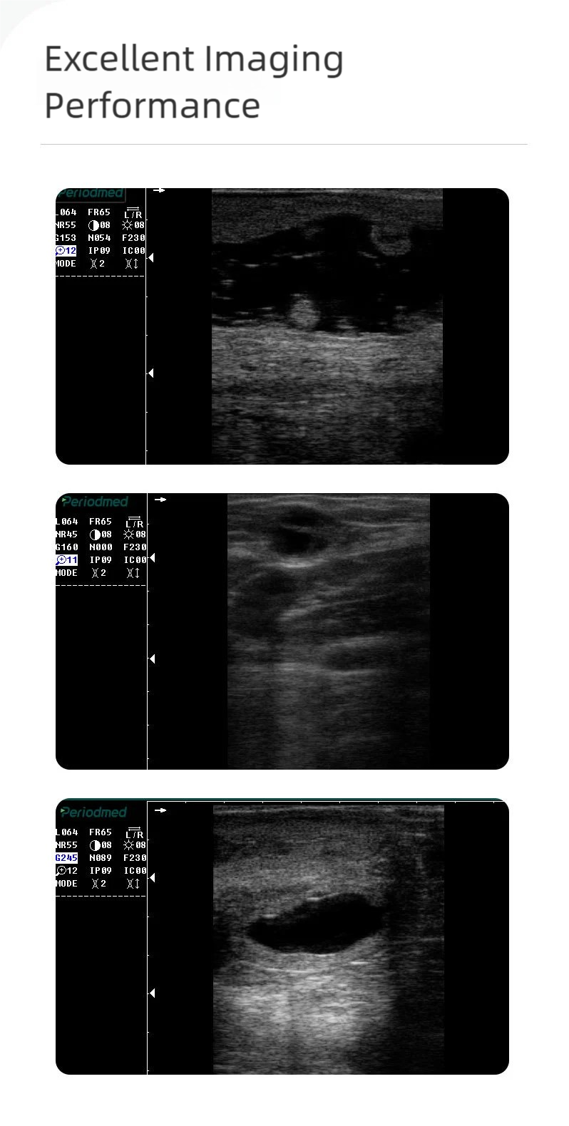 S8aa5ab0b462849fab2ea9964bf1c047b6-1