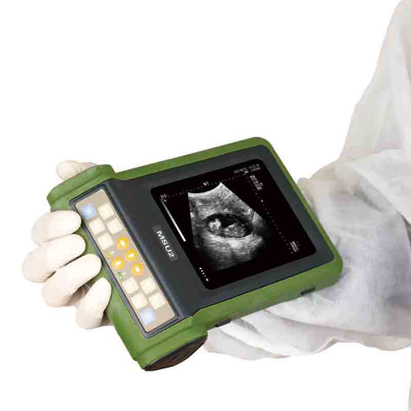 Sa5885afa06ec4b628f36fea03b335425J-1